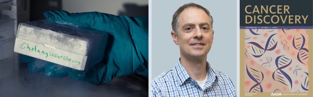 2025 YIR blogpost cholangio collage